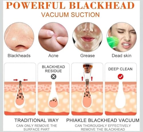 Image of 6 in 1 Multi-function Blackhead Remover Tools | Electric Derma suction Machine | USB Rechargeable Acne Pimple Pore Cleaner Vacuum tool - Facial Cleanser Device for Nose & Skin Care(6 in 1 WHITE)