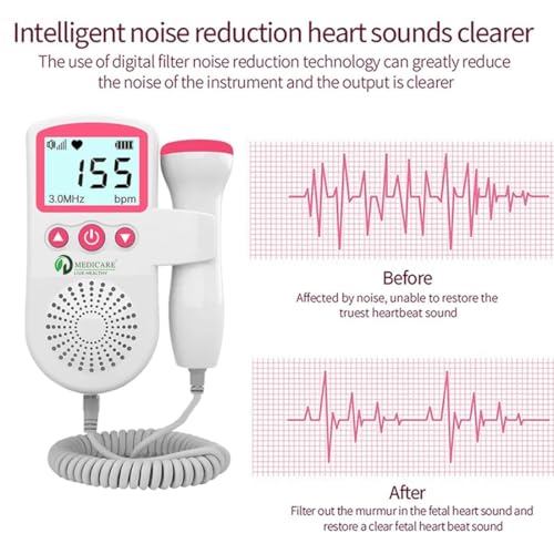 Image of Portable Fetal Doppler Baby Heartbeat Monitor for Pregnancy | Digital LCD Display with in-Built Speaker, Accurate FHR Detection | Compact Prenatal Monitor for Home & Clinic Use (Blue)