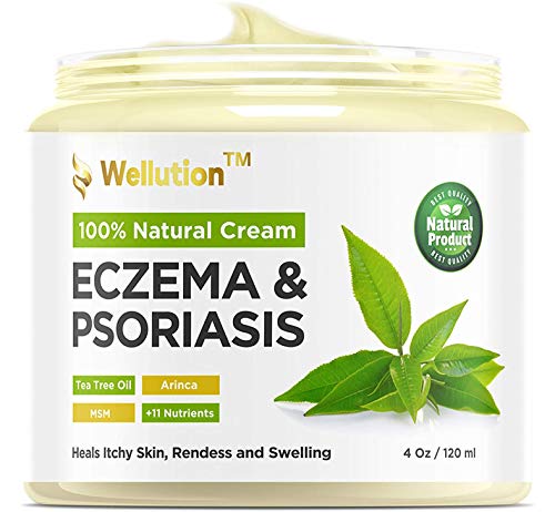Wellution Natural Eczema and Psoriasis Cream – Intensive All in 1 Treatment – Soothe & Relieve Skin Irritations Quickly– Made in USA