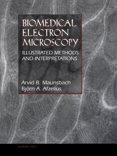 Biomedical Electron Microscopy: Illustrated Methods and Interpretations Biomedical Electron Microscopy: Illustrated Methods and Interpretations