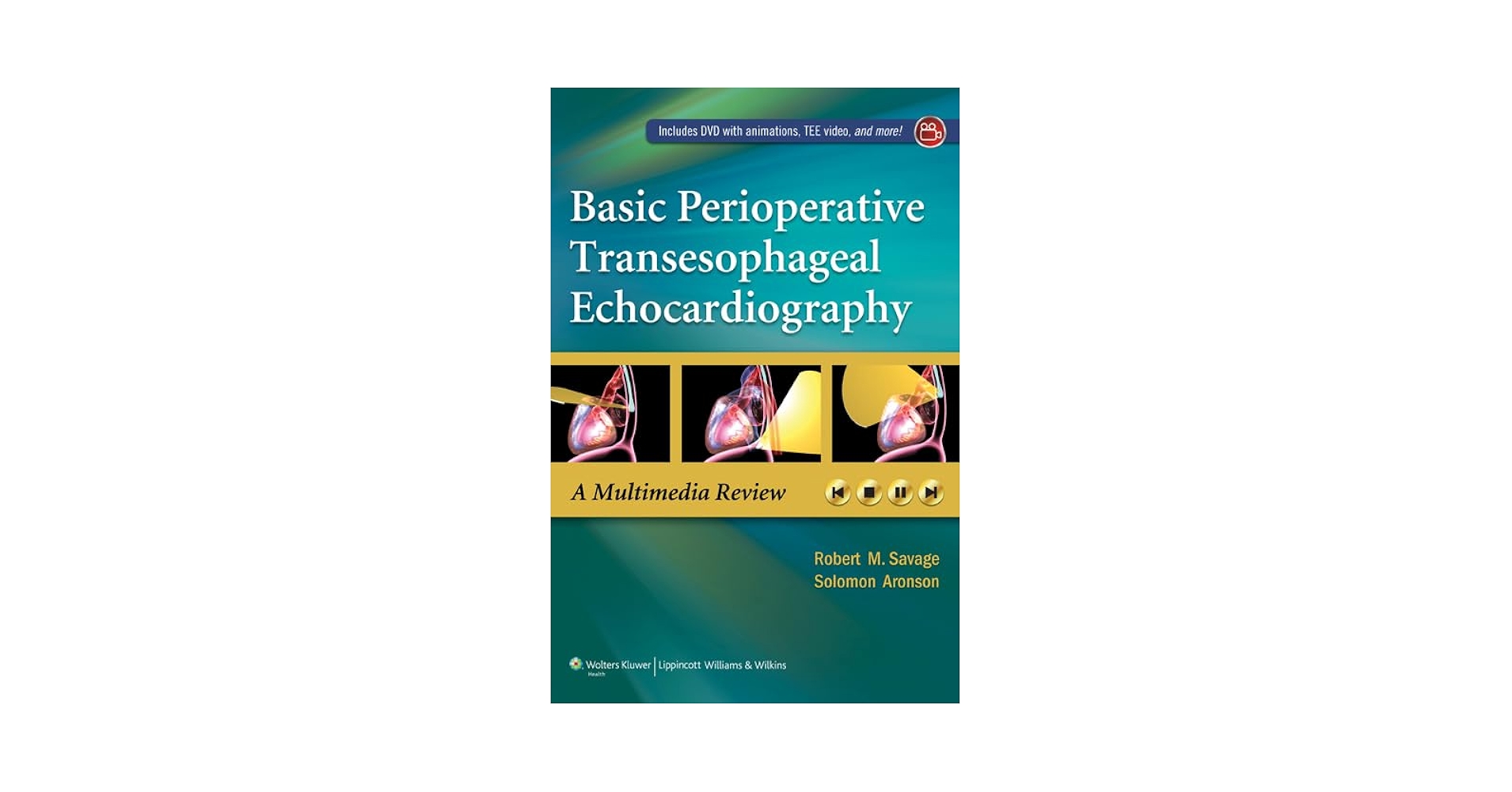 健康・医学 PERIOPERATIVE TRANSESOPHAGEAL Basic Perioperative Transesophageal Echocardiography: Savage