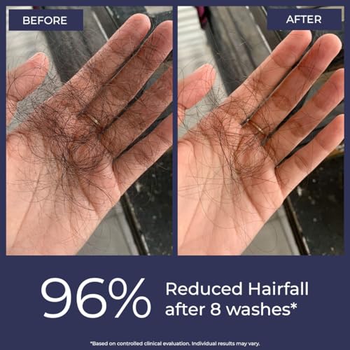 Image of Conscious Chemist Anti Hairfall Shampoo & Conditioner Combo | Saw Palmetto, Yeast Extract, Rosemary Oil, Keratin & Ceramides | Hair Fall Control, Hair Growth & Frizz Reduction | Sulfate & Paraben Free | For All Hair Types | Women & Men