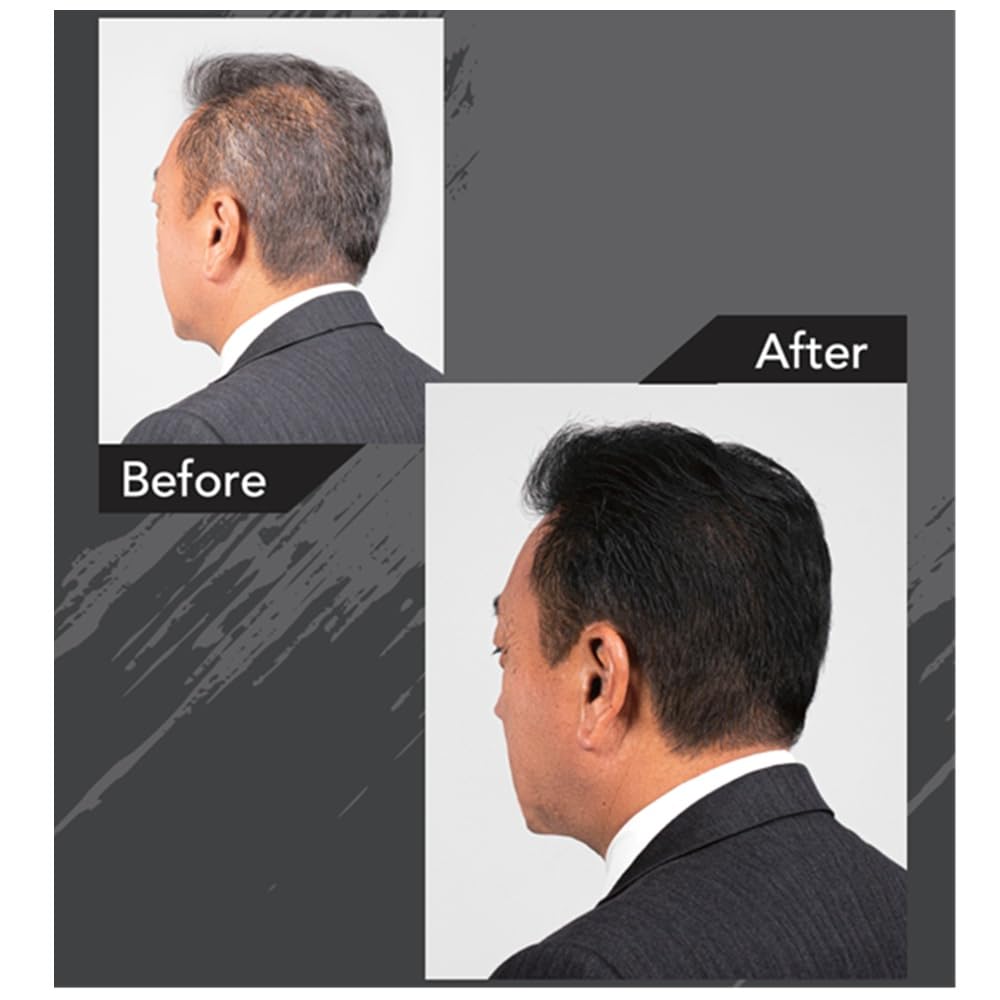 Amazon.co.jp: 黒ばら本舗 黒染 ボリュームアップヘアスプレー150g+