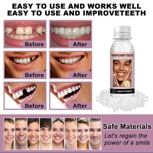 Image of Tooth Repair Kit, Moldable Tooth Filling Repair Kit with 4 Dental Tool, Tooth Filling Kit Fixing The Missing and Broken Replacements, DIY Natural Filling Fake Teeth,Smile Confidently Again