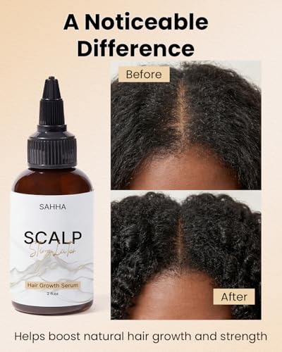 Sahha Hair Growth Oil with Rosemary, Mint & Retinol, 4 fl oz — view 6