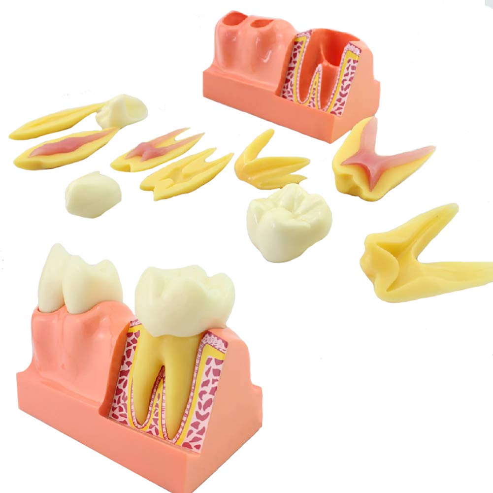 Teeth Anatomical Models 4 Times Magnification Tooth Decomposition Model Enamel, Dentin, Crown, Root and Pulp, Resin Teeth, Imported Transparent Silicone Rubber Gingival Mucosa Product Weight 0.5kg