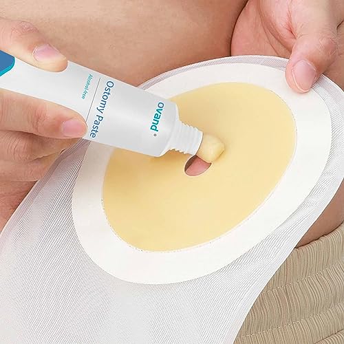 stoma skin barrier ostomy paste - protective ostomy skin barrier supplies - stoma adhesive skin protectant paste - ostomy skin barrier paste 2 oz