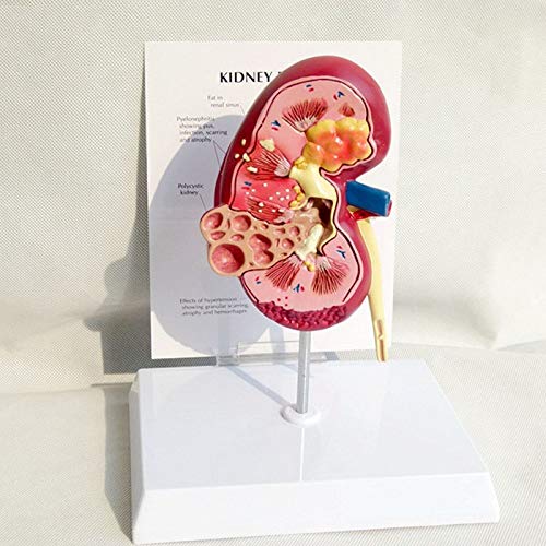 Buy LXT PANDA Human Kidney With Adrenal Gland Model Kidney W 