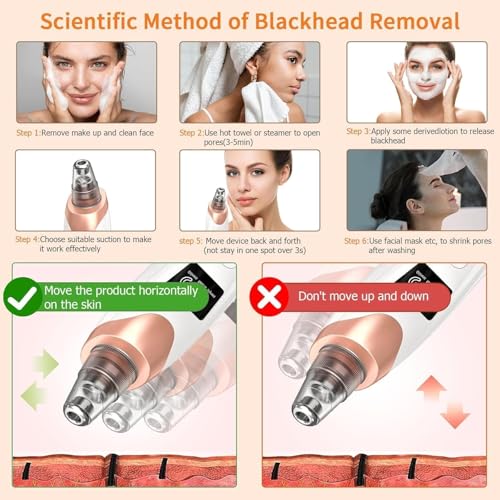 Image of 5 in 1 Multi-Function Blackhead Whitehead Remover Device, Skin Cleaner, Pimple Removal Tool, Acne Pimple Cleaner Vacuum Suction for Men and Women (5 in 1 Plus Blackhead) (white)