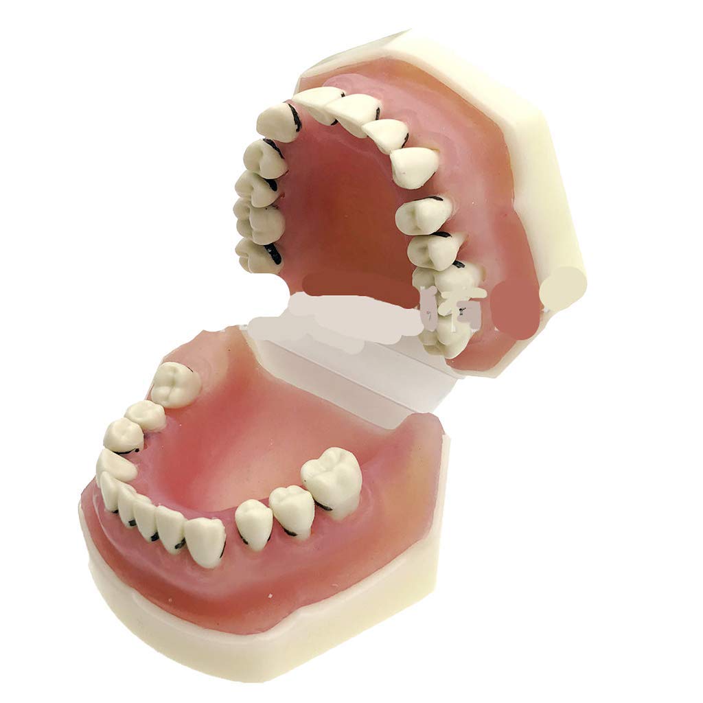 Modello Didattico di Denti Standard Ortodontici per Studenti di Odontoiatria Infantile, Modello Anatomico Dentale, Modello Dimostrativo Dentale