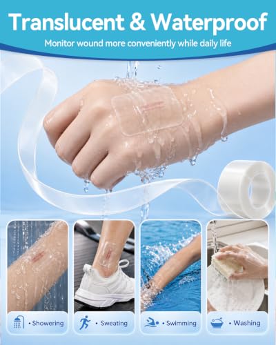 Image of Ourmed Medical-Grade Hydrocolloid Roll with Box (2 Roll), Waterproof Hydrocolloid Bandages for Wound Care and Minor Burns, Pimple Patches for Acne Care, First Aid Supplies for Home & Outdoor, 2in*5ft