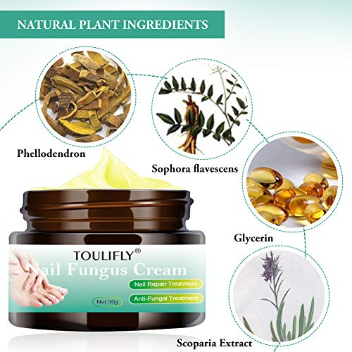 Nail Fungus Cream,Toenail Fungus Treatment,Nail Fungus Remover,Toenail Fingernail Fungus Remover Fungus Stop Cream