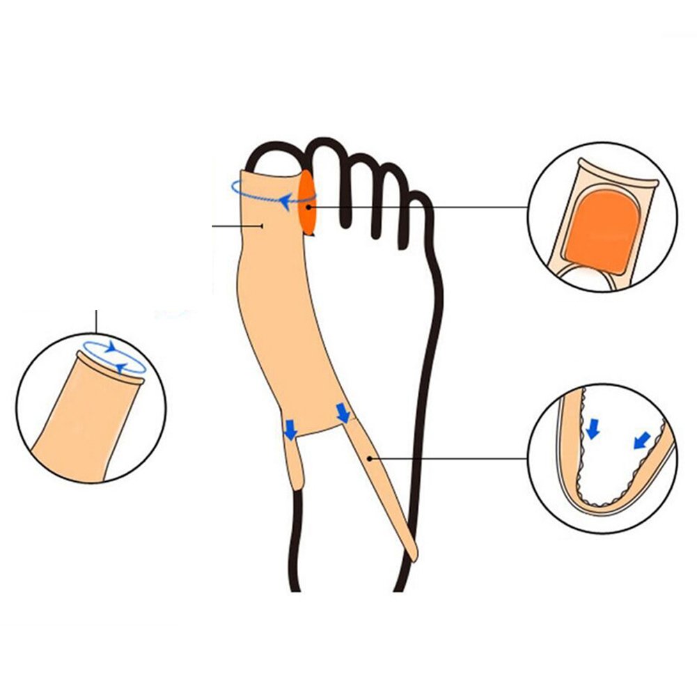 Pedimend Hallux Valgus Footpad 1 Piece