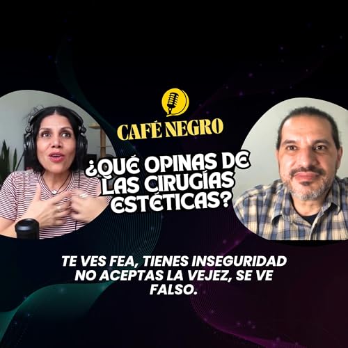 La GENTE a&uacute;n NO ACEPTA que te pongas BOTOX, FILLERS, cirug&iacute;as