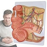 Modelo de recto humano y apéndice con marca digital para entrenamiento del sistema digestivo anorrectal, ideal para estudiantes de medicina y formación de médicos