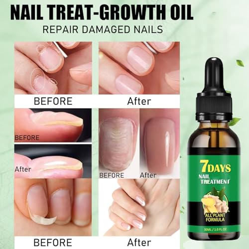 7 days Nail Treatment, 7 Days Ginger Nail Treatment, Multi-Purpose Nail Repair(2PCS) - Image 5