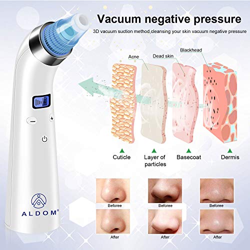 Blackhead Remover Pore Vacuum Facial Nose Pore Cleaner Acne Comedone Pore Extractor Electric Blackhead Whitehead Removal Suction Tool for Skin Care Women Men - Thumbnail 6