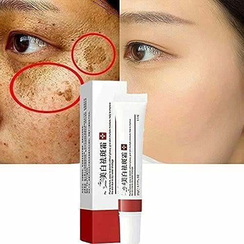 Amazon.com: VoaiBekt Crema para Manchas Oscuras en La Cara, Cremas para