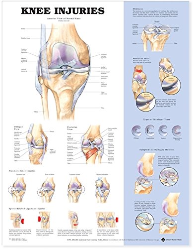 Anatomy And Injuries Of The Hip Anatomical Chart (9781587793837)
