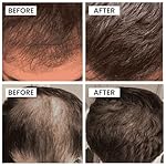 Luxe Cosmetics Hair Growth Serum for Men – 1 fl oz Scalp & Beard Serum with Biotin & Caffeine – Lightweight Leave-In Formula for Thicker-Looking Hair – Non-Greasy Grooming Essential - Image 5