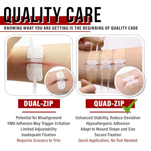 Image of EVERLIT Wound Closure Pack | 4 Pcs Surgical Wound Zip Devices for Cut & Laceration Wound Repair | Sterile, Suture-Free, Stitch-Less Adhesive Butterfly Bandage Strips for Emergency First Aid Care