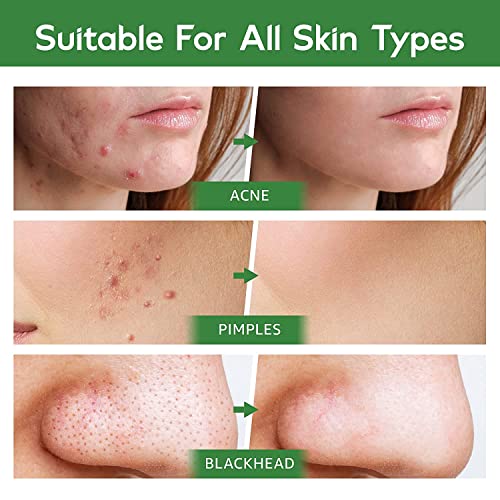 Navabelle Green Tea Mask Stick, Premium Blackhead Remover Stick, Green Mask Stick For Blackheads, Green Tea Mask For Deep Pore Cleansing And Moisturizing, Skin Brightening For All Skin Types (2Pcs) #TOP6