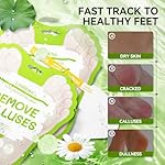 LANBENA Aloe Vera Foot Peeling Mask(2 Pairs), Foot Mask for Dry Cracked Feet, Exfoliator Peel Off Calluses Remove Dead Skin Callus Remover, Repair Rough Heels & Get a Baby Soft Feet for Men and Women - Image 4
