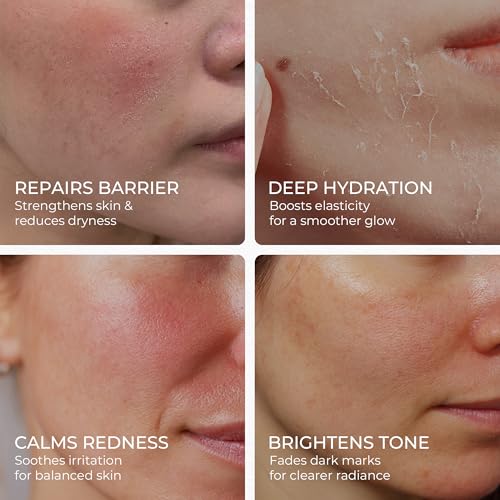 MATRÚM Organic Barrier Repair Face Serum – Brightening, Firming & Hydrating Serum for Dry & Sensitive Skin | Soothes Redness & Dryness | with Niacinamide, Vitamin E & Camelina Seed Oil — view 3