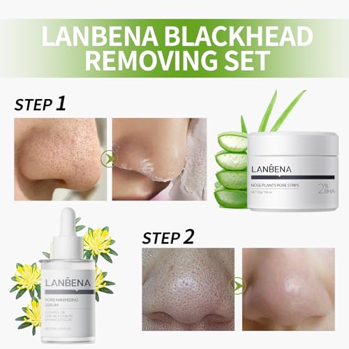 LANBENA 3 in 1 Mitesserentferner Set Tiefenreinigung Porenstreifen, Klärendes Serum & Entfernen Papiere Nase & Gesicht Mitesser Behandlung Minimiert Poren & Verfeinert Hauttextur Hinterlässt Haut