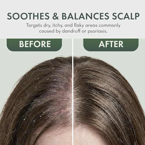Leave In Conditioner Spray - Tea Tree Scalp Treatment - Anti-Dandruff and Dry & Itchy Scalp Treatment, Hydrating & Medicated Formula for Psoriasis and Scalp Care - Detangles & Nourishes Hair. - Image 6