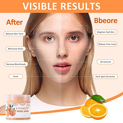 Vitamin C Facial Scrub & Facial Exfoliator, Deep Cleansing Exfoliating Face Scrub, Brightening Facial Scrub, Facial Scrub Exfoliator For Blackhead Improve Dark Spots Acne For All Skin Types - 3.25 Oz #TOP2