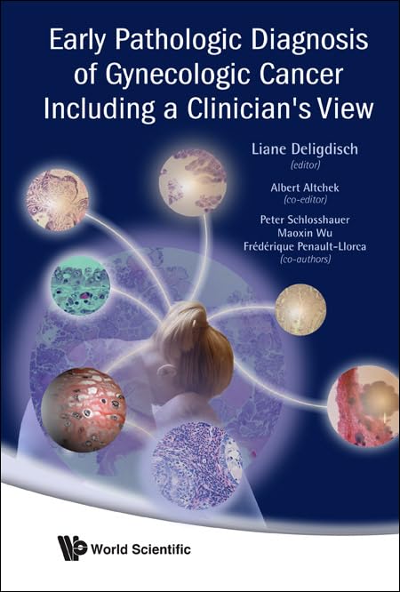 EARLY PATHOLOGIC DIAGNOSIS OF GYNECOLOGIC CANCER INCLUDING A CLINICIAN'S VIEW 1st Edition