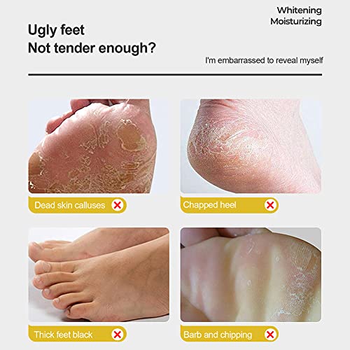 Ingzy Shea Butter Foot Repair Cream, Skin Healing Ointment For Cracked Heels And Dry Feet - Foot Massage Exfoliating Cream With Mineral Oil Ceramide (1 Pack Foot Cream) #TOP5