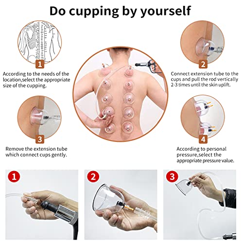 Cupping Therapy Set,32 Therapy Cups Cupping Set With Pump, Professional Chinese Acupoint Cupping Therapy Sets Hijama For Cupping Massage, Muscle&Joints #TOP4