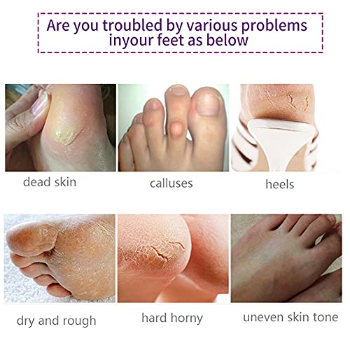 Foot Peel Mask 5 Pack,Lavender Exfoliating Foot Masks, Soft Smooth Touch Natural Exfoliator For Dry Dead Skin, Callus, Repair Rough Heels,Gifts For Women Mom And Men #TOP1