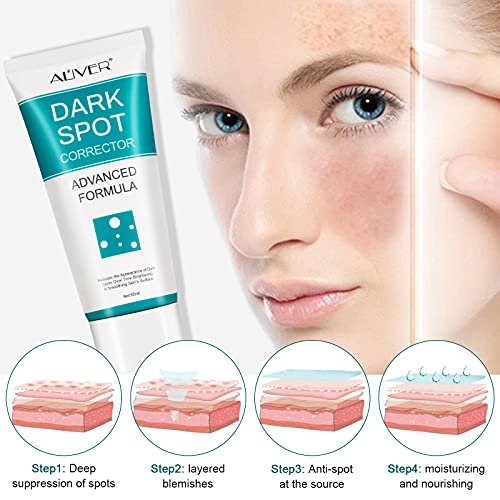 Dark Spot Remover For Face, Dark Spot Corrector Cream, Fade Out The Skin Black Precipitate, Remove Freckle For Face, Fade Spots For All Skin Tone Types #TOP14