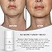 Blissava Neck Firming Cream - Neck Tightening Cream - Turkey Neck Cream - Erase Crepe Skin Wrinkles Sagging Skin Fine Lines and Double Chin for Face Neck And Decollete for Men and Women