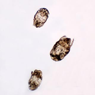 Dust Mites, w.m., Individual Microscope Slide