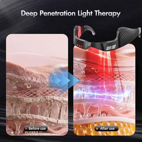 Image of Red Light Therapy Eye Massager for Puffy Eyes & Wrinkles, Rechargeable Care Device, Under Eye Red Light Therapy Device for Dark Circles, Eye Bags & Puffiness periorbital(Black)