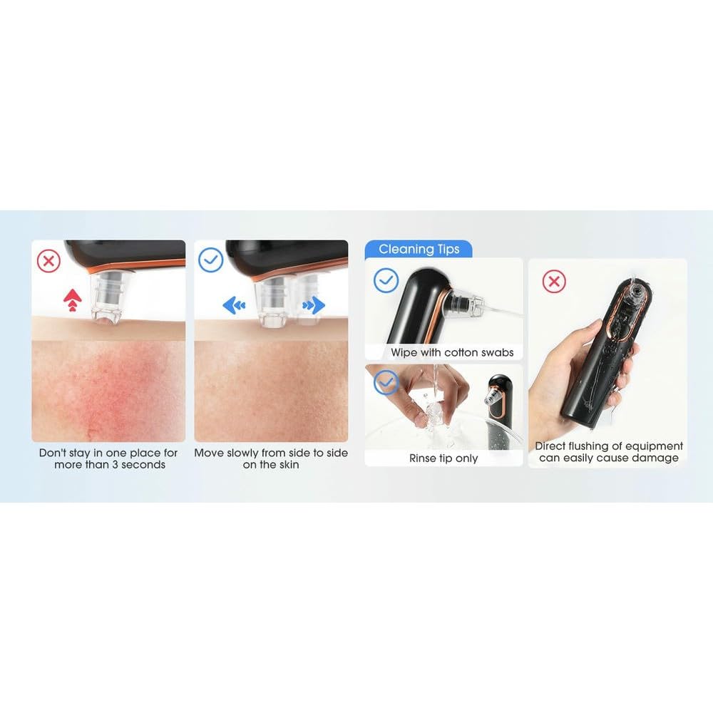 NYSDM - Aspirapolvere Elettrico per la rimozione dei Punti Neri, Strumento per la Pulizia Profonda dei pori, Compatto e con Display, per la Pulizia Profonda del Viso, per Rimuovere l'acne