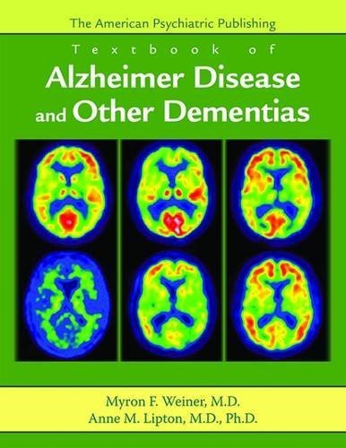 American Psychiatric Publishing Textbook of Alzheimer's Disease and Other Dementias: The App Textbook of Geriatric Psychiatry Diagnostic Issues in Dementia (2009-03-15)