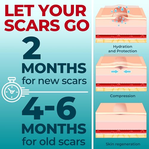 medical grade silicone scar tape - 16x150 - visible difference on keloid amp -section - reusable silicone scar sheets - easy to use