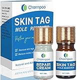 Skin Tag Removal - All Natural Mole and Skin Tag Remover and Repair Lotion- Large Skin Tag Remover - Plant-Based Formula - Easy to Use Skin Tag Remover Kit - Safe Mole and Tag Remover