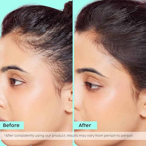 Image of PLIX THE PLANT FIX Rosemary Hair Growth Advanced Hair Spray 100ml Pack of 2 | Rosemary Extract, Redensyl, AnaGain & Baicapil | Lightweight Daily Scalp Spray | For Hair Fall Care & Fuller-Looking Hair