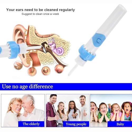 Ohrenschmalz Entferner- Elektrisch Ohrenreiniger, Sicheres Und Weiches Ear Cleaner, Mit 2 Waschbaren Ersatzköpfen Und Batterie, Geeignet Für Kinder Und Erwachsene Ohr Reinigung (A)