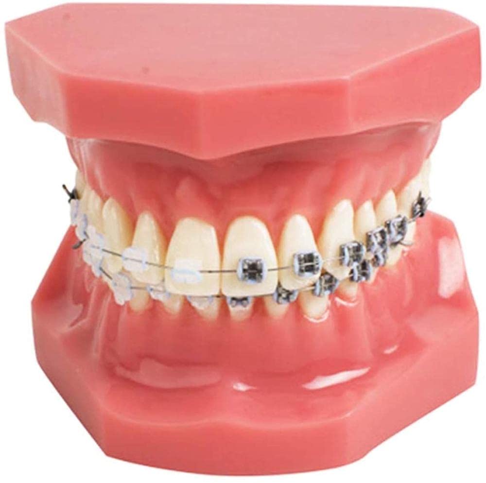 NaoSIn-Ni Model do nauki model zębów dentystyczne malokluzja ortodontyczne leczenie l nauka zębów do nauki 1 szt. medyczne narzędzie do nauki zabawka