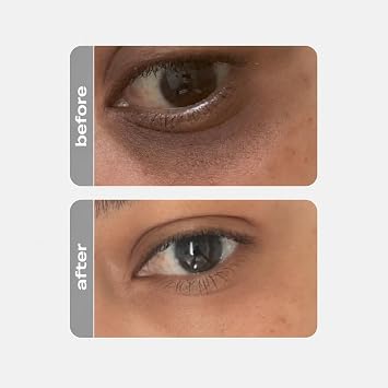 Creamy Eye Cream | Brightening Anti-Wrinkle Cream for Firmness | Dark Circles, and Puffiness