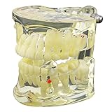 AC Typodont Tooth Model Dental Kids Pathological Display (Children Model M4002,1 Pcs)