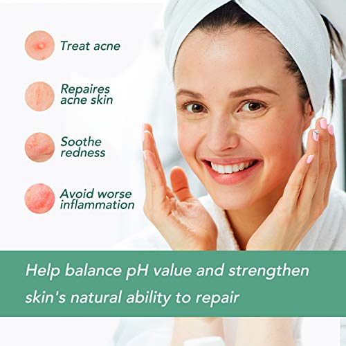 Akne Behandlung Anti Akne Spot Pickel Creme Makel Breakout Behandlung Gesicht Akne Narbenentfernung Gel-Creme reduziert Rötungen natürliche Hautpflege (60 g) - Image 6