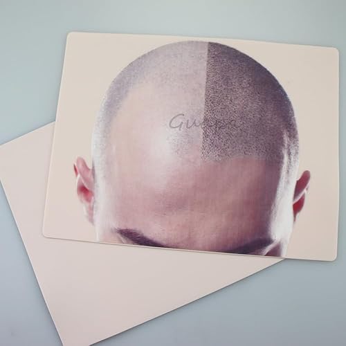 Miniatura 2 de 2 piezas de piel de práctica de micropigmentación del cuero cabelludo masculino para adelgazamiento del cabello tatuaje y densidad del cabello